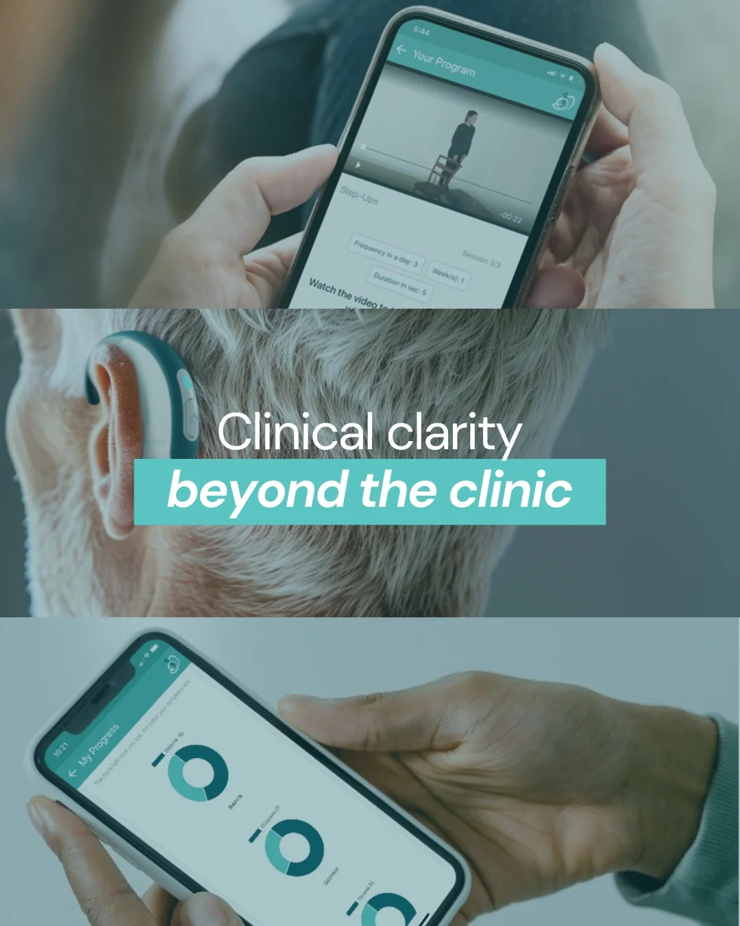 therapeutic monitoring health technology interface for remote vestibular rehab